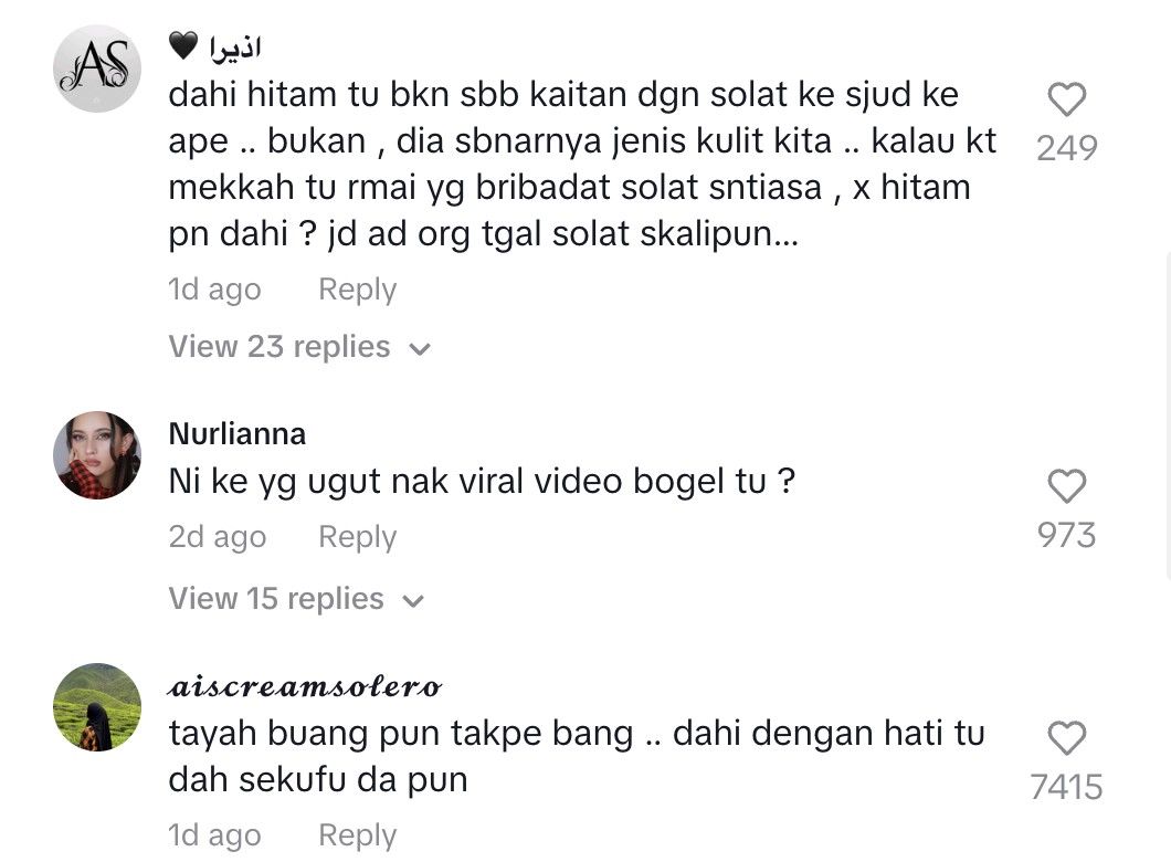 Andika Putera buang tanda hitam